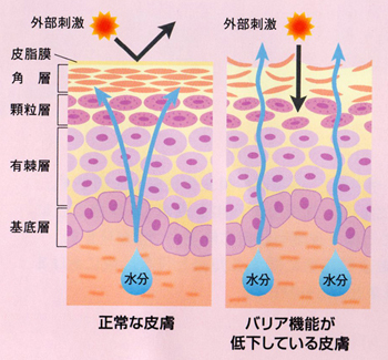 肌の老化は光老化が8割!　紫外線でゴースト血管にもなりやすい!